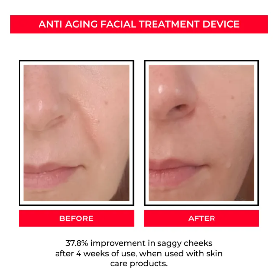 EMS Facial Care Device