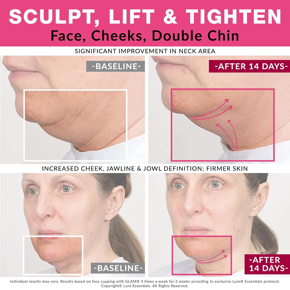 Facial Cupping Massage Set